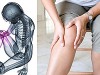 Лечение различных патологий крупных суставов (коленные тазобедренные локтевые плечевые).